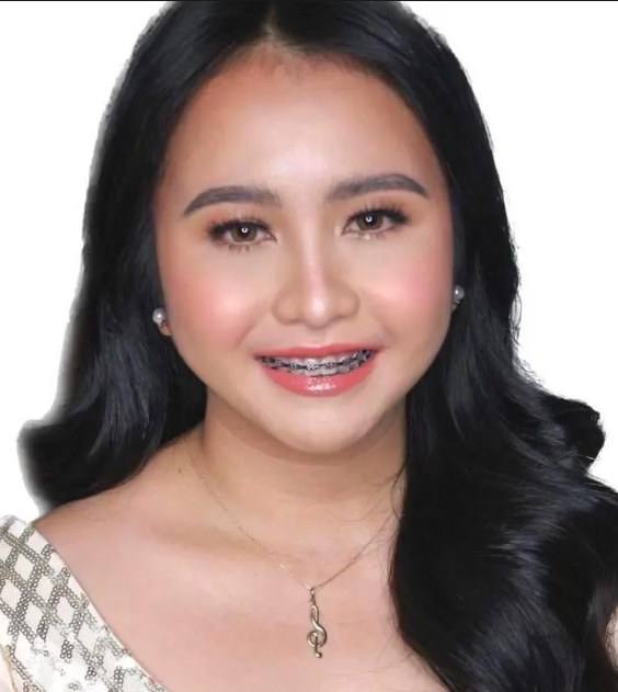Dr. Princes Luise Dela Tina-Picaza
